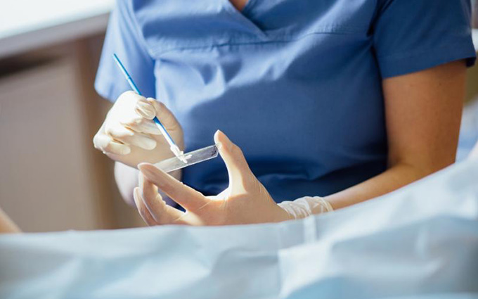 Cervical screening update