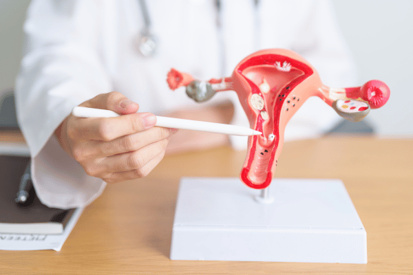 Myomectomy Surgery Melbourne